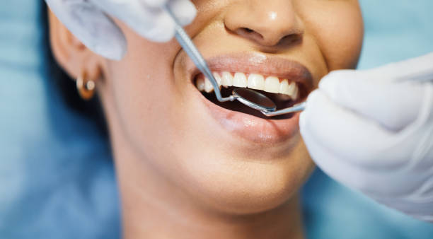 Best Emergency Dental Care for Broken or Chipped Teeth in Tomahawk, WI